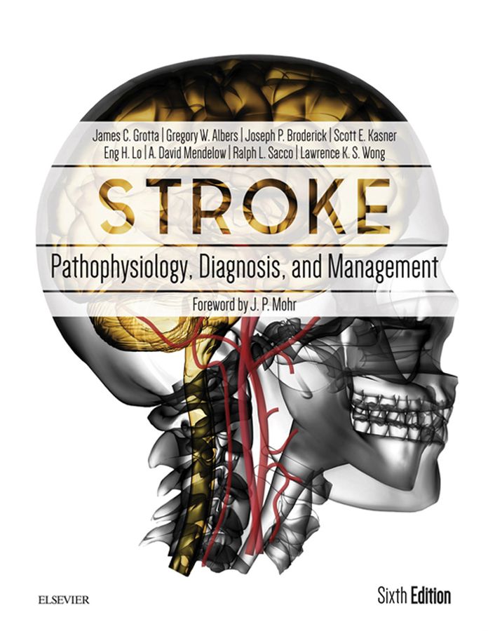 Stroke E-Book: Pathophysiology, Diagnosis, and Management