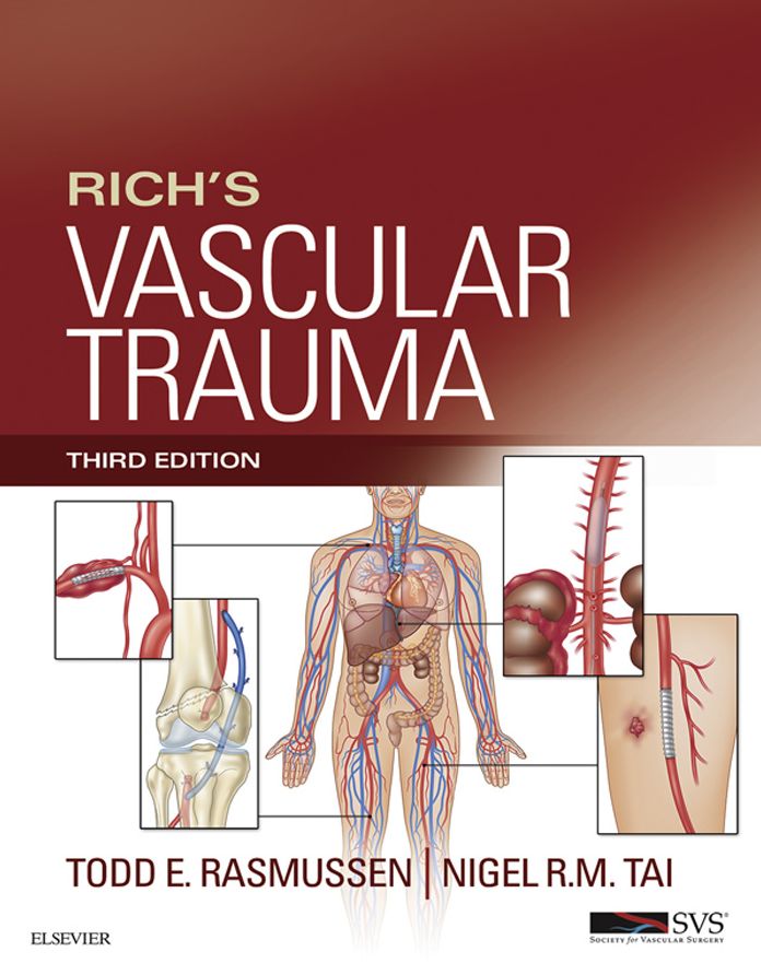 Rich's Vascular Trauma E-Book