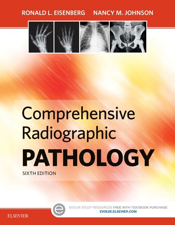 Comprehensive Radiographic Pathology - E-Book