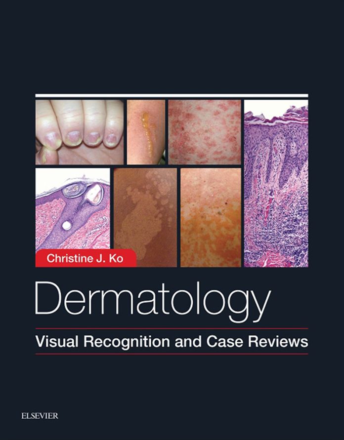 Dermatology: Visual Recognition and Case Reviews E-Book