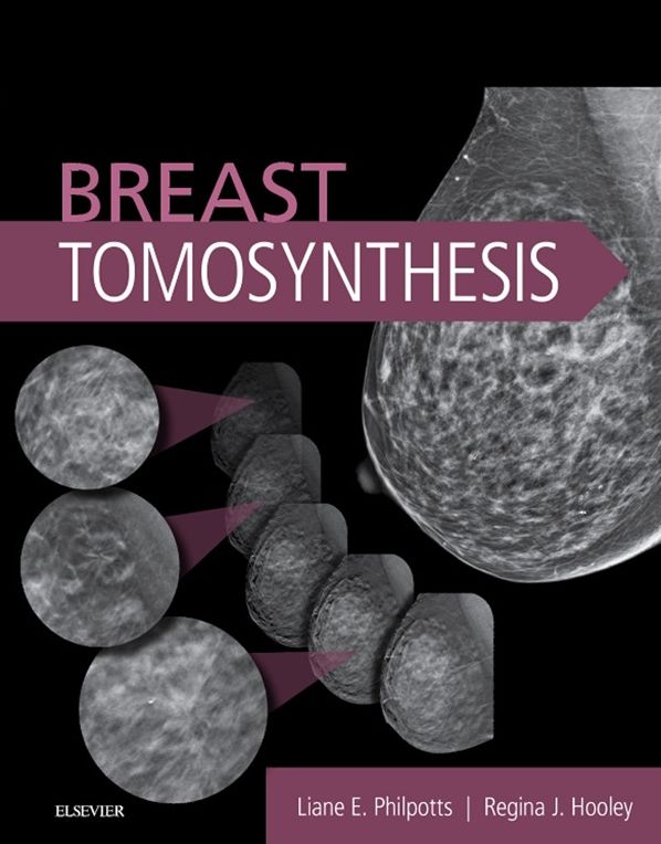 Breast Tomosynthesis E-Book