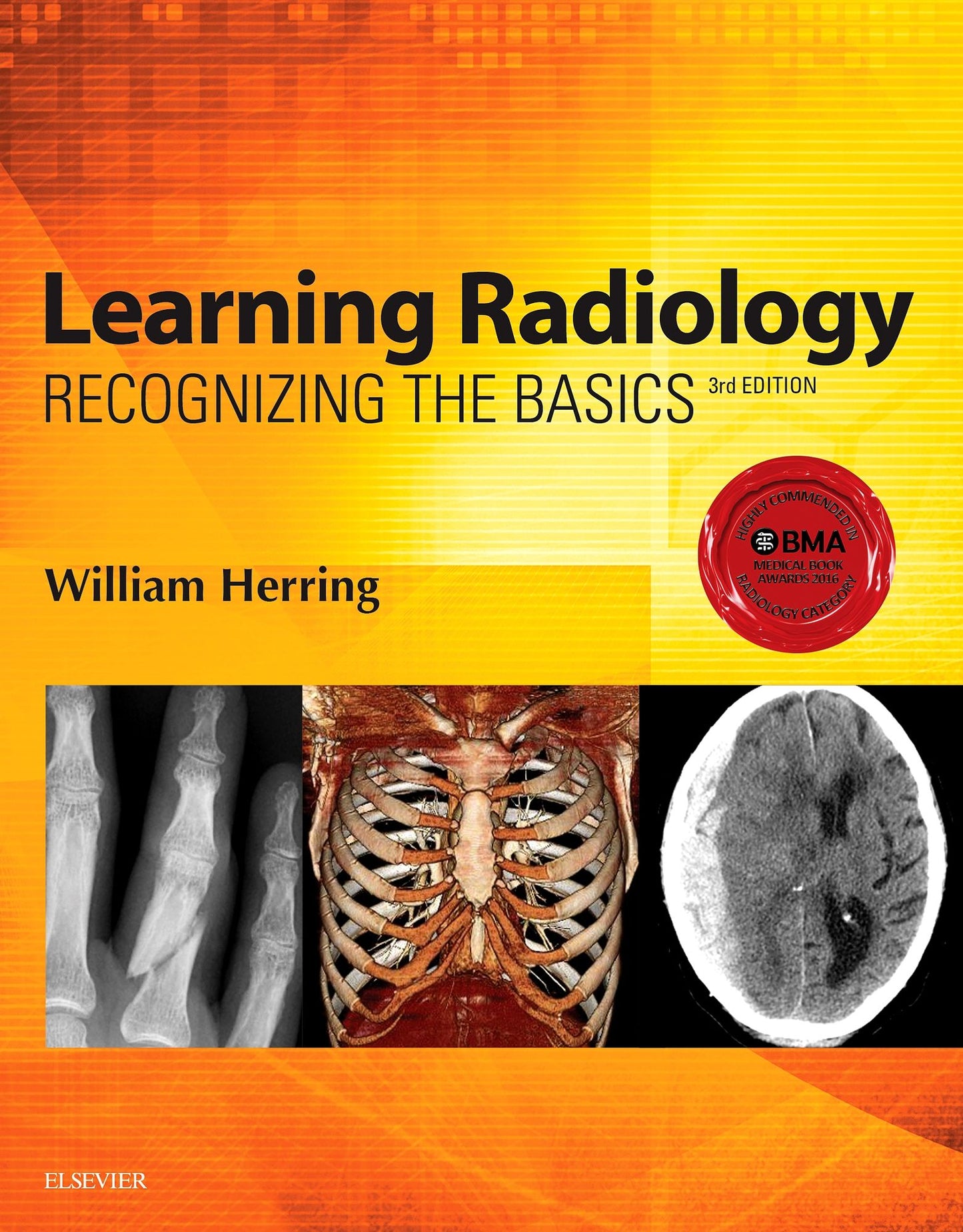 Learning Radiology E-Book: Recognizing the Basics