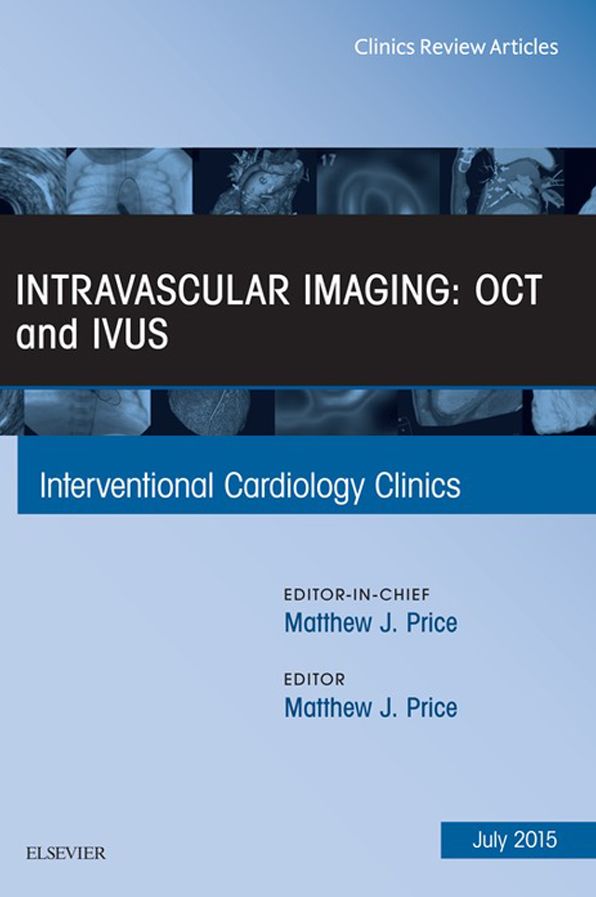 Intravascular Imaging: OCT and IVUS, An Issue of Interventional Cardiology Clinics, E-Book