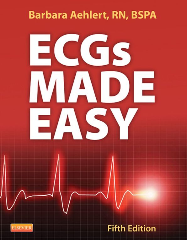 ECGs Made Easy - E-Book