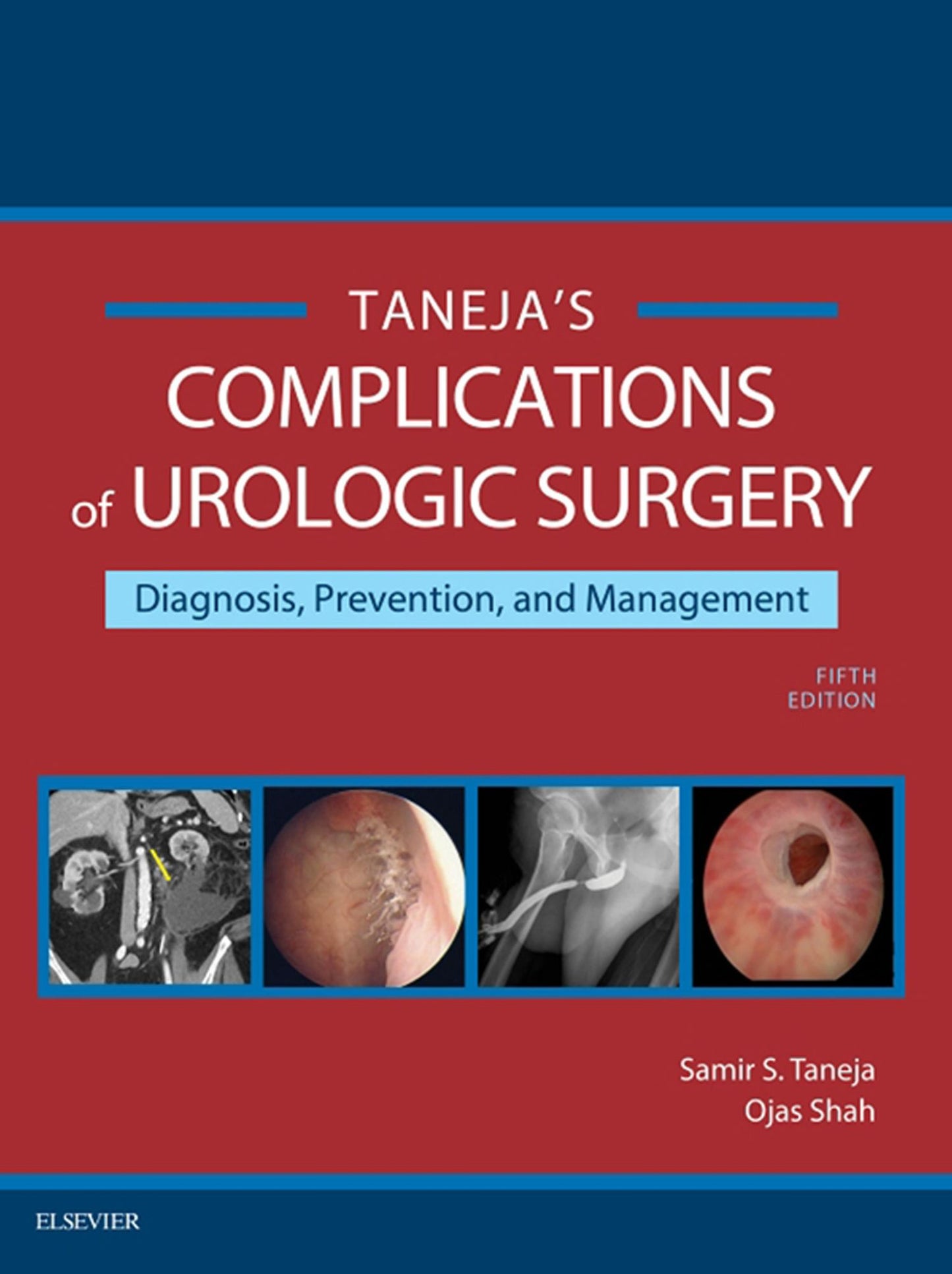 Complications of Urologic Surgery E-Book: Prevention and Management
