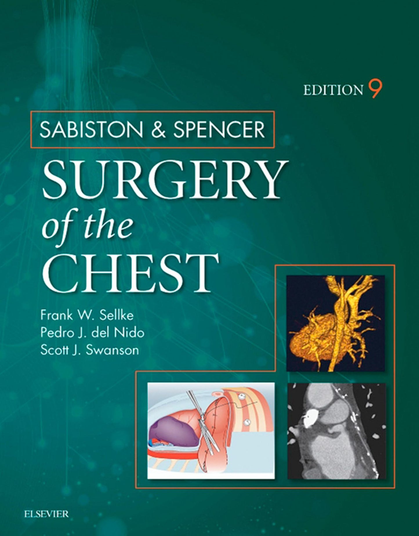 Sabiston and Spencer Surgery of the Chest E-Book