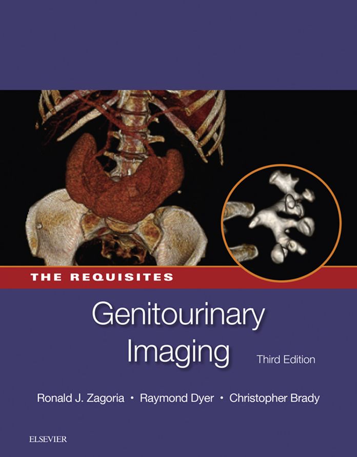 Genitourinary Imaging: The Requisites E-Book