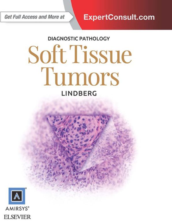 Diagnostic Pathology: Soft Tissue Tumors E-Book