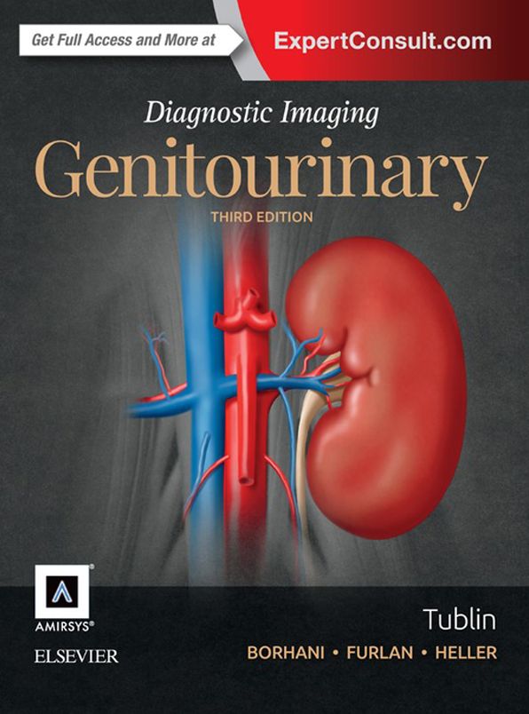 Diagnostic Imaging: Genitourinary E-Book