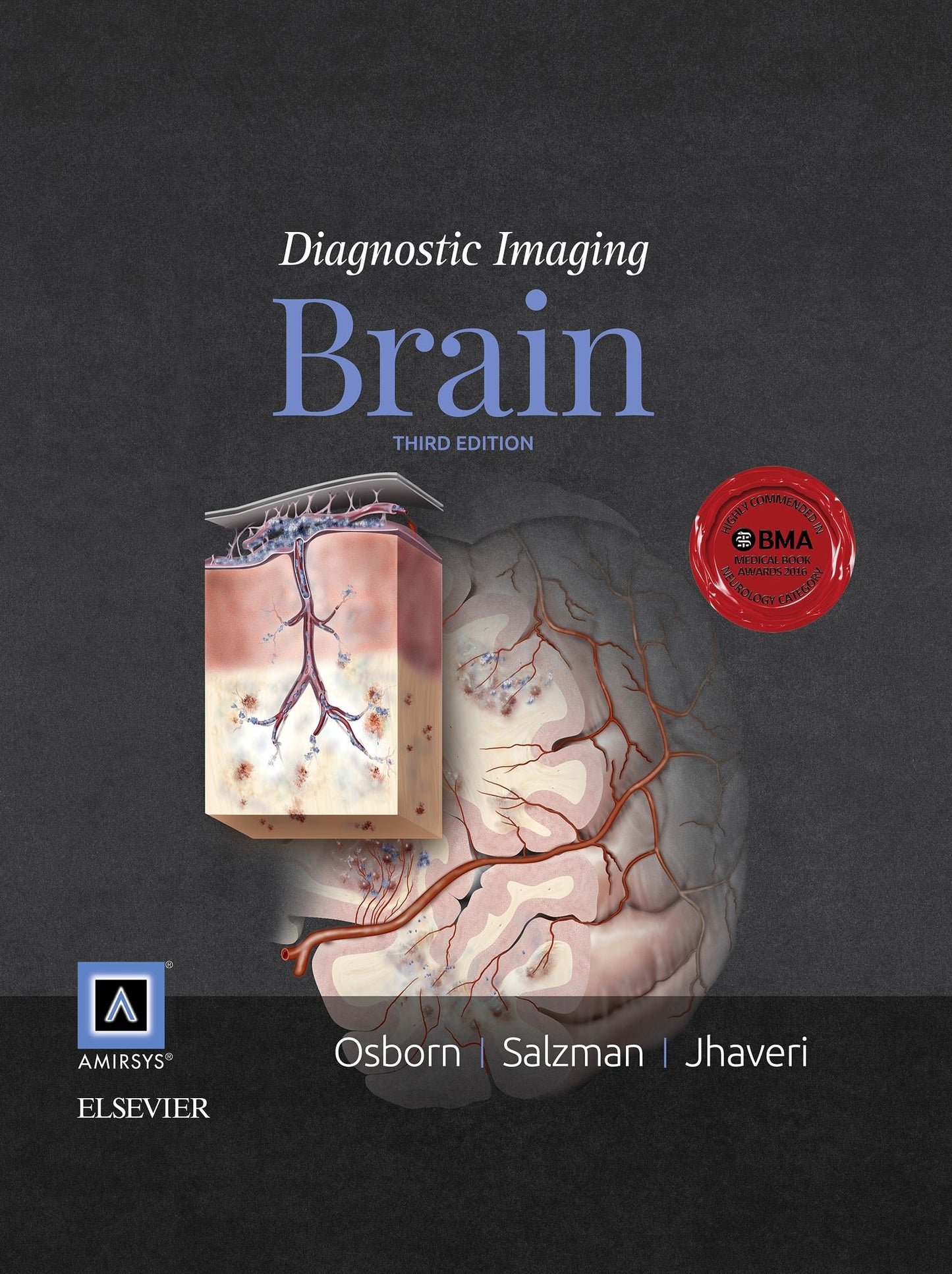 Diagnostic Imaging: Brain E-Book