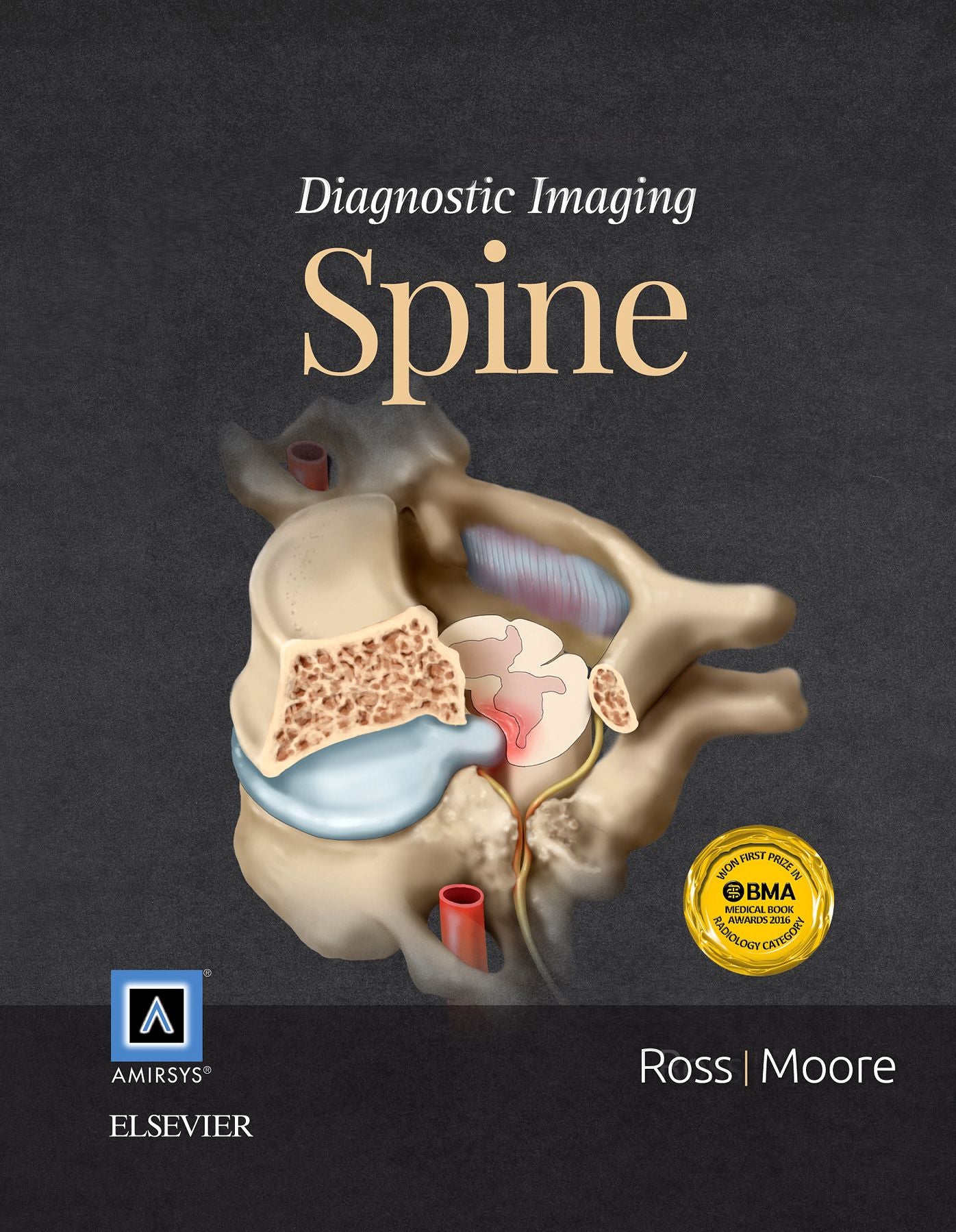 Diagnostic Imaging: Spine E-Book