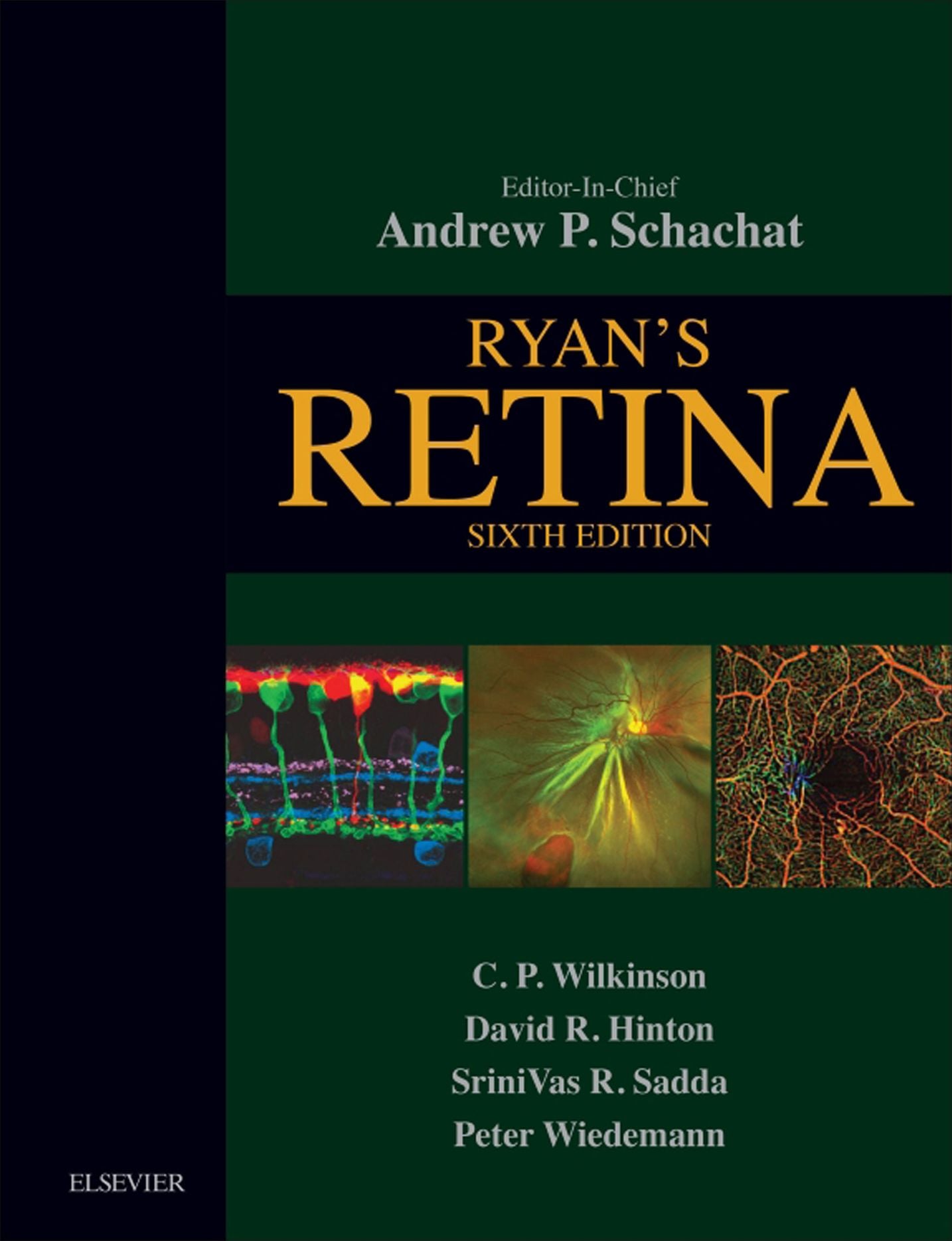 Ryan's Retina E-Book