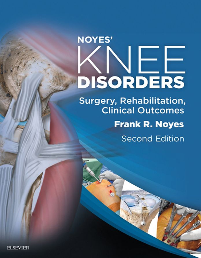 Noyes' Knee Disorders: Surgery, Rehabilitation, Clinical Outcomes E-Book