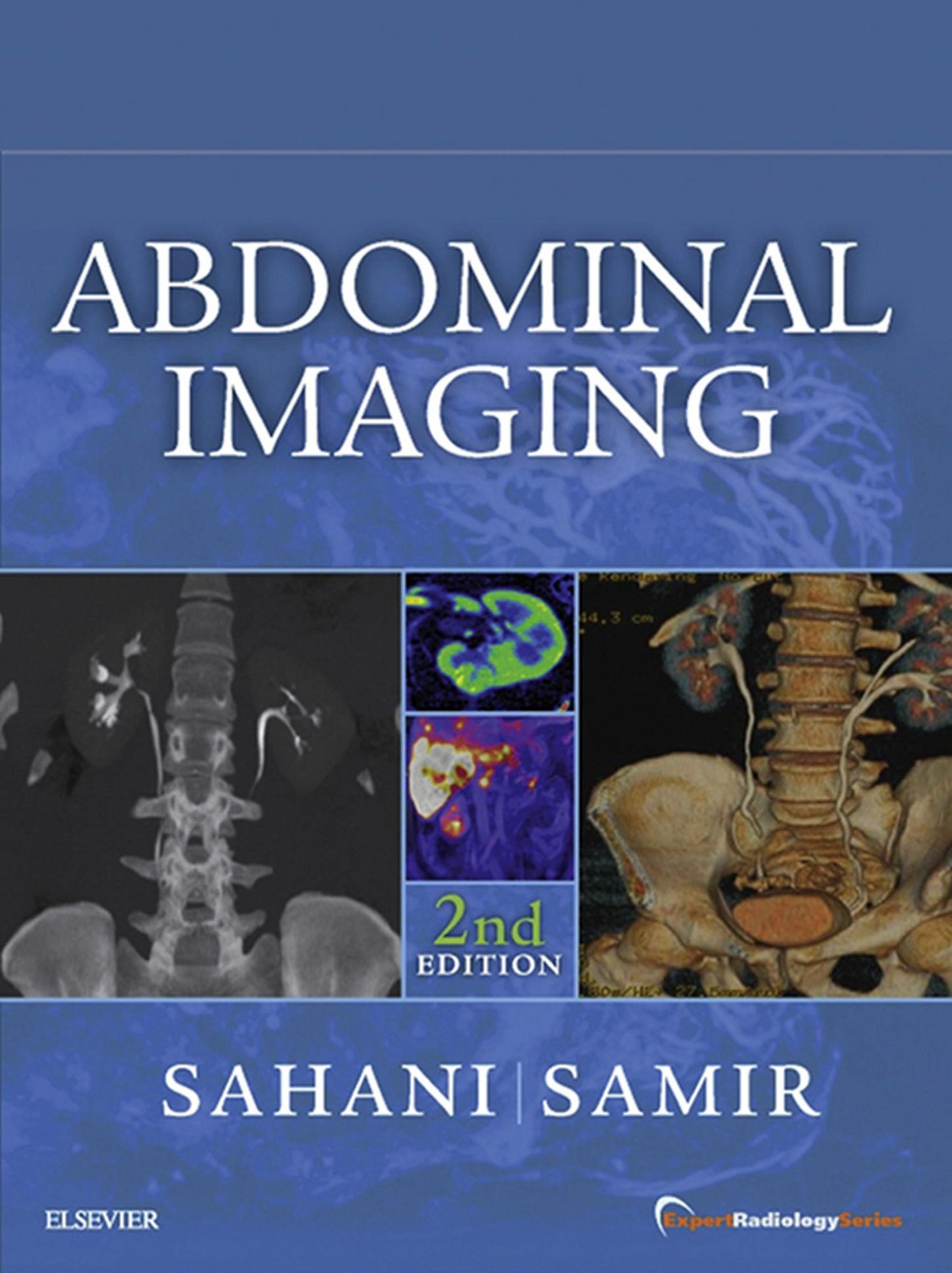 Abdominal Imaging E-Book: Expert Radiology Series