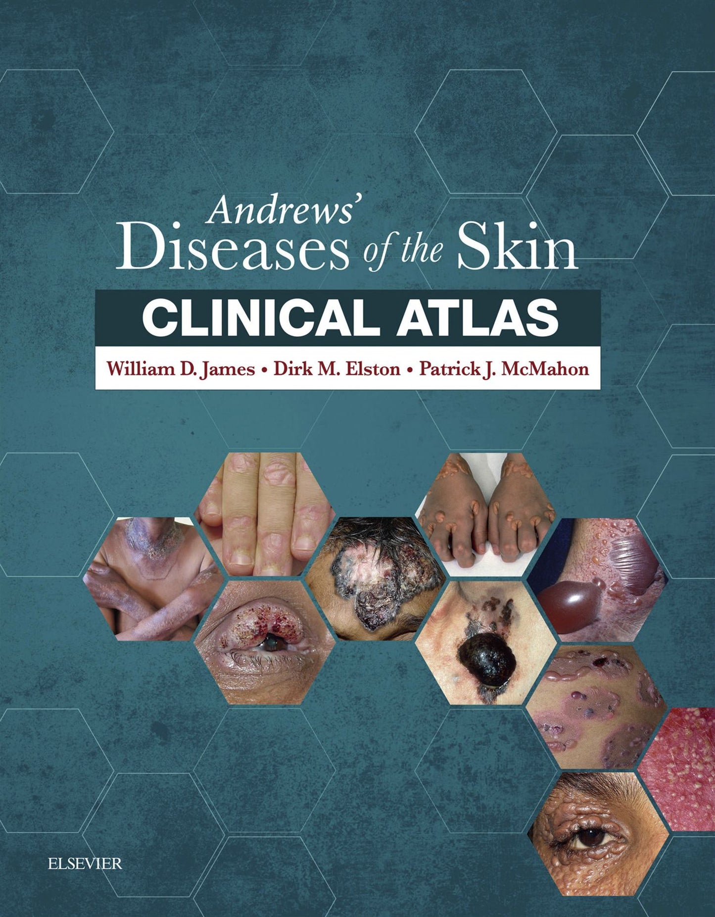 Andrews' Diseases of the Skin Clinical Atlas E-Book: Expert Consult