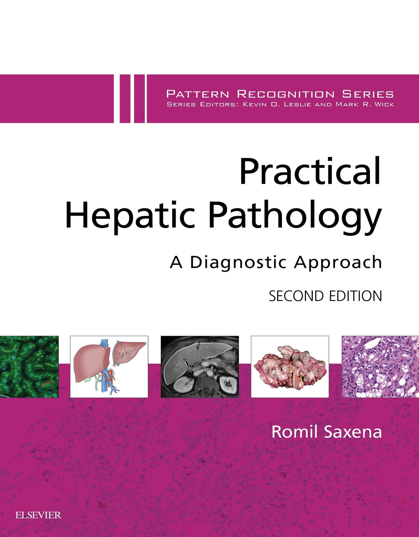 Practical Hepatic Pathology: A Diagnostic Approach E-Book: A Volume in the Pattern Recognition Series