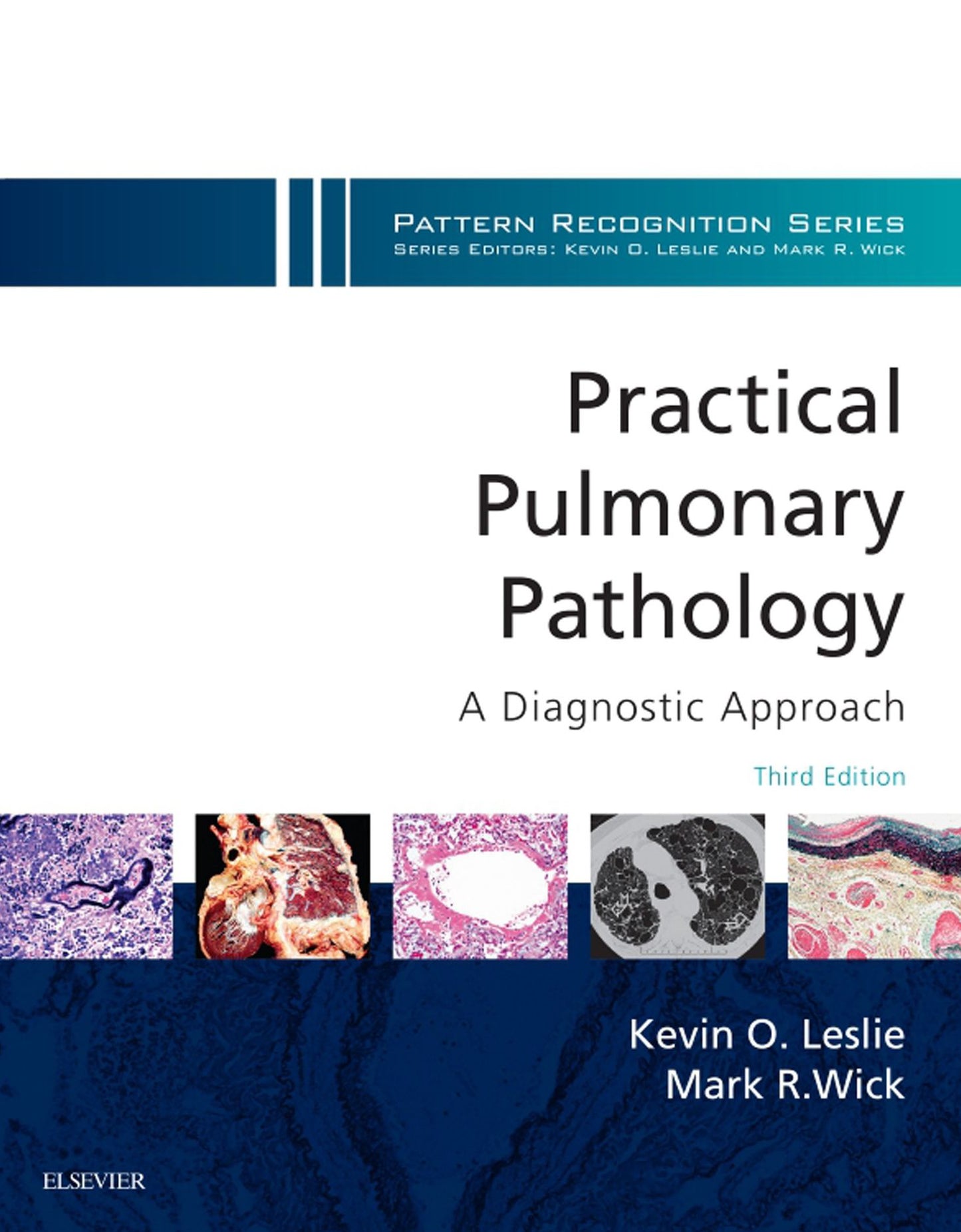 Practical Pulmonary Pathology: A Diagnostic Approach E-Book: A Volume in the Pattern Recognition Series