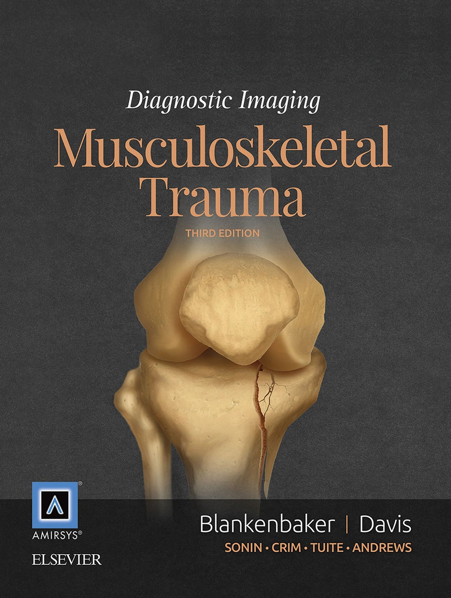 Diagnostic Imaging: Musculoskeletal Trauma E-Book