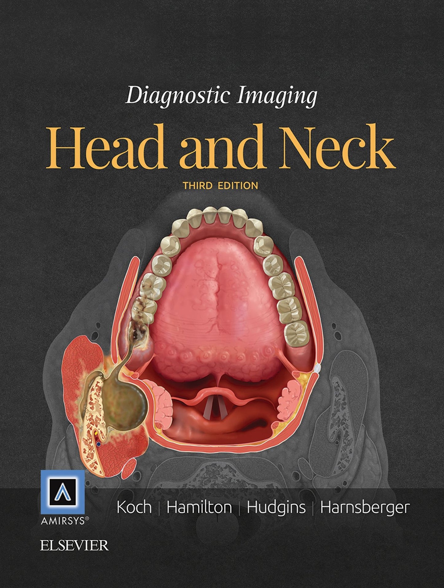 Diagnostic Imaging: Head and Neck E-Book
