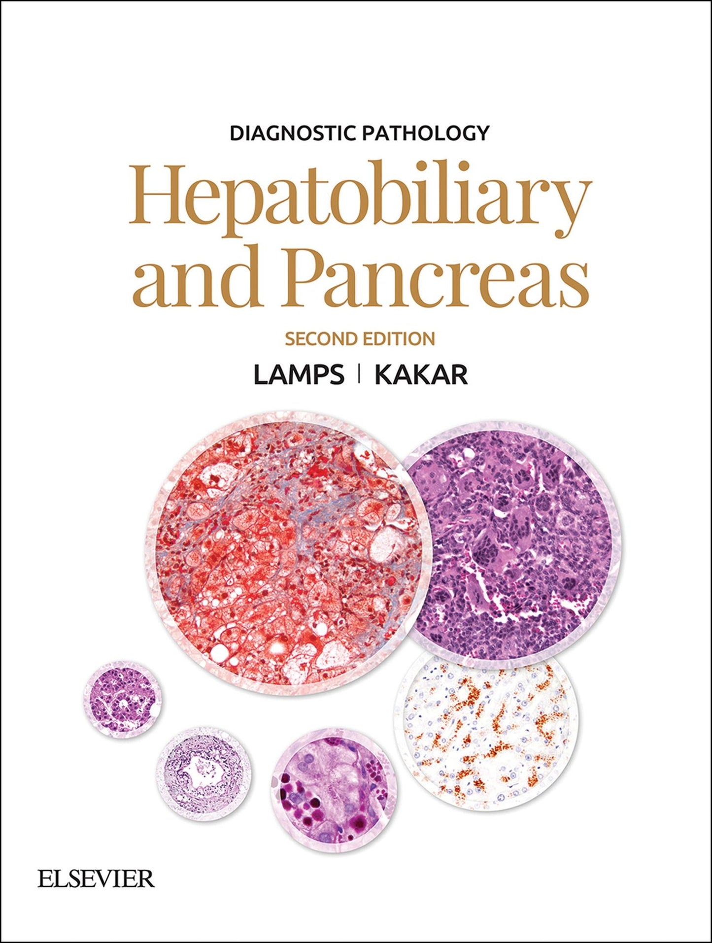 Diagnostic Pathology: Hepatobiliary and Pancreas E-Book