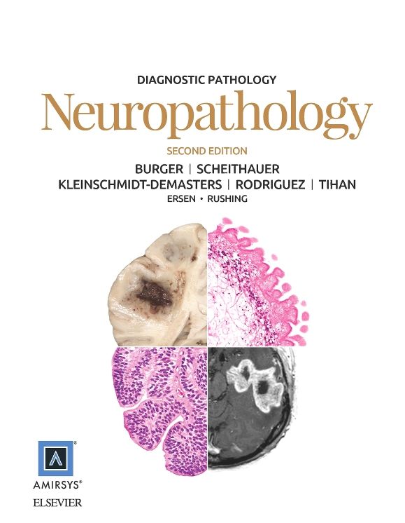Diagnostic Pathology: Neuropathology E-Book