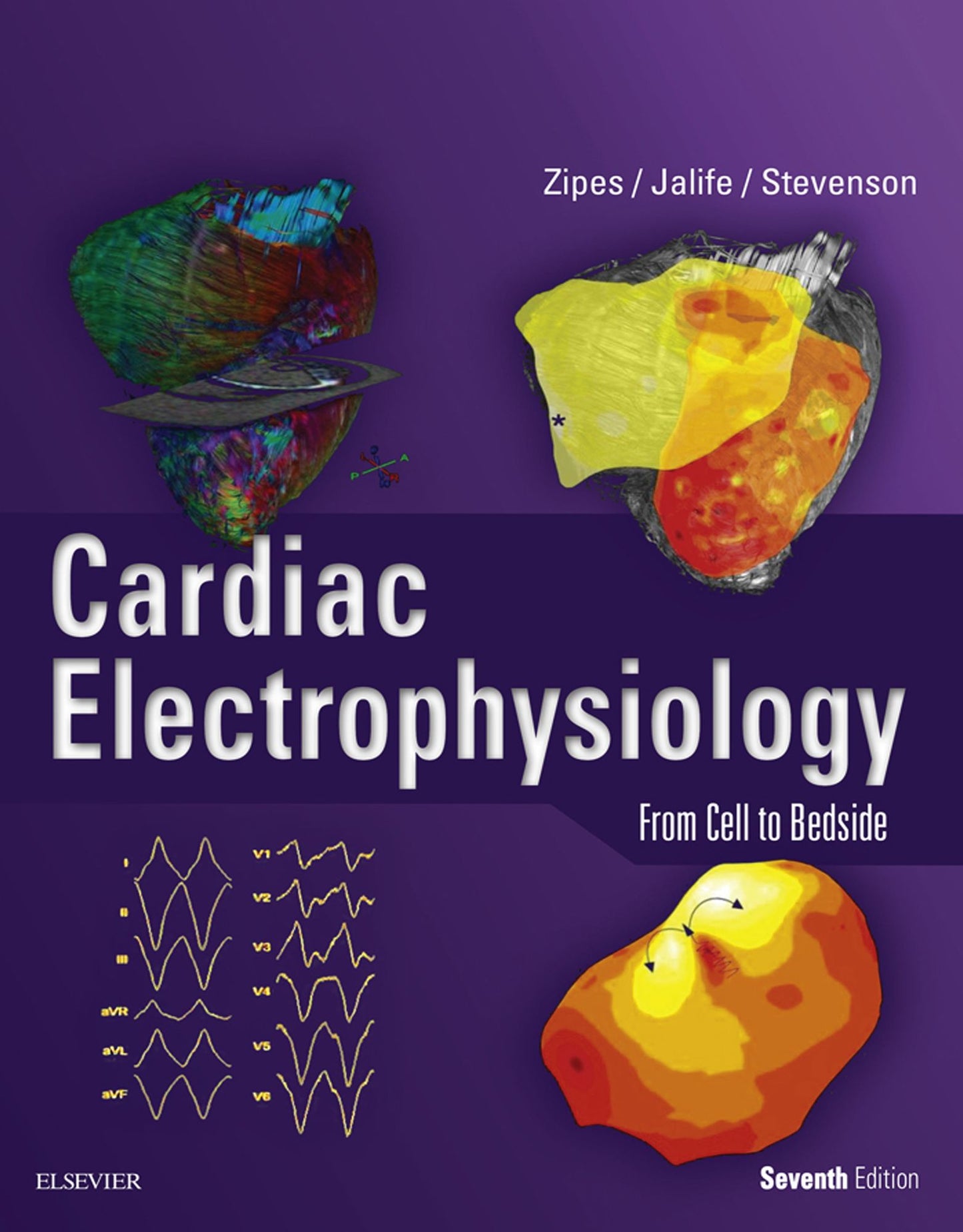 Cardiac Electrophysiology: From Cell to Bedside E-Book