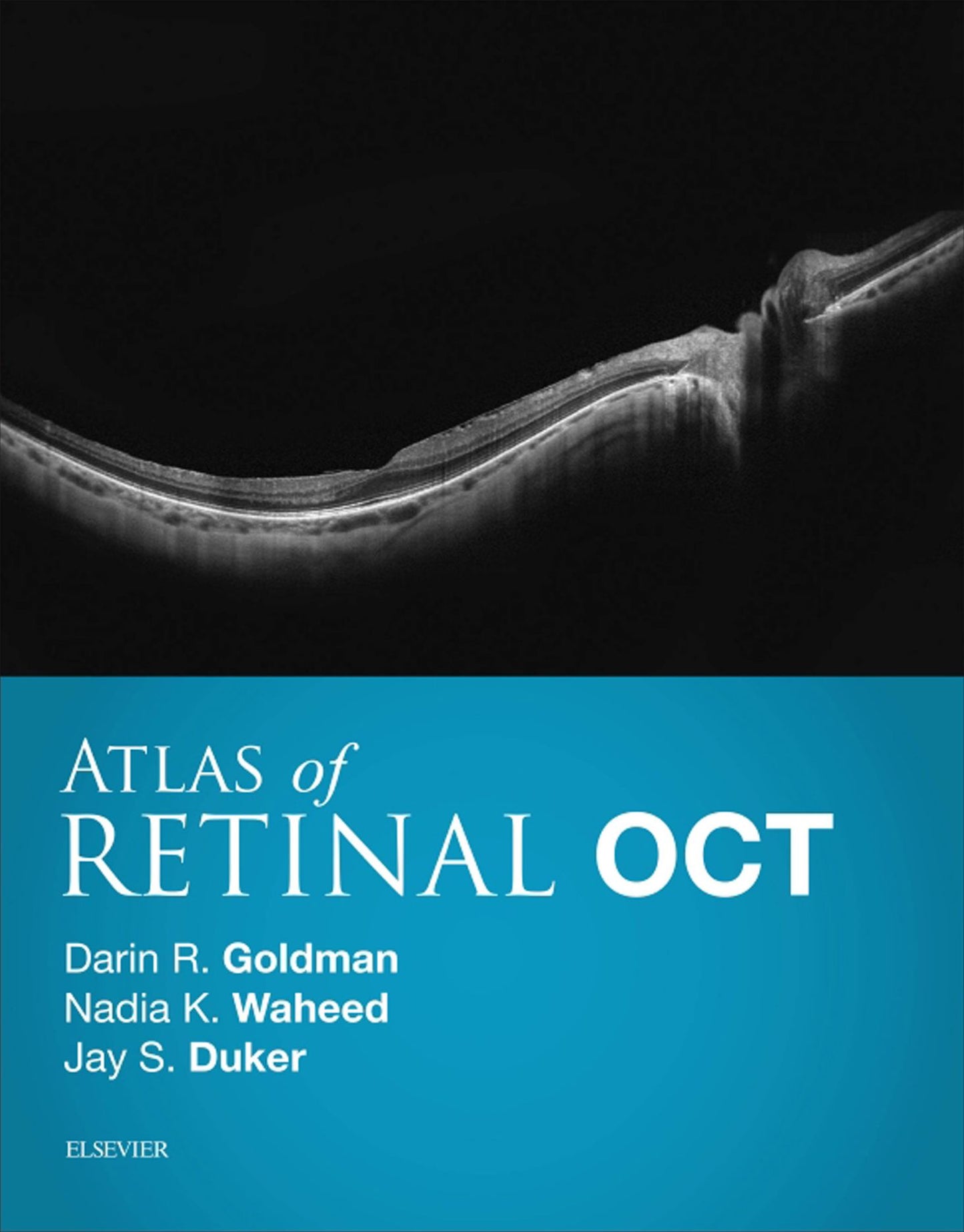 Atlas of Retinal OCT E-Book: Optical Coherence Tomography