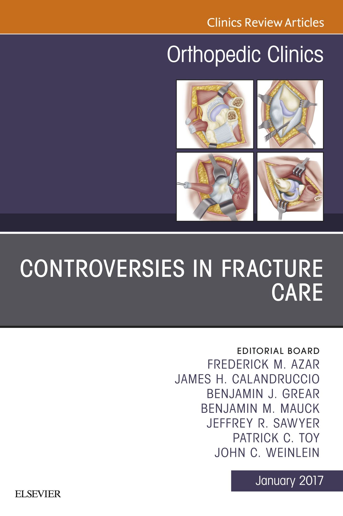 Controversies in Fracture Care, An Issue of Orthopedic Clinics, E-Book
