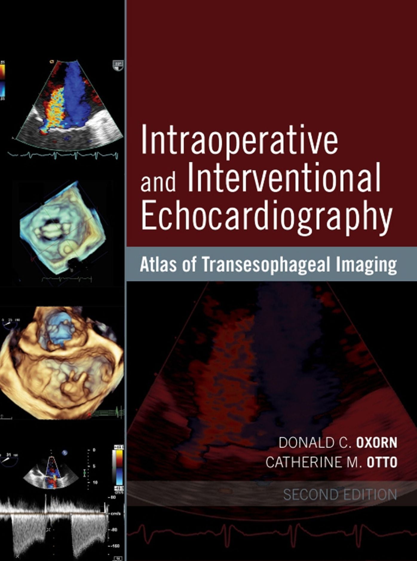Intraoperative and Interventional Echocardiography: Atlas of Transesophageal Imaging E-Book