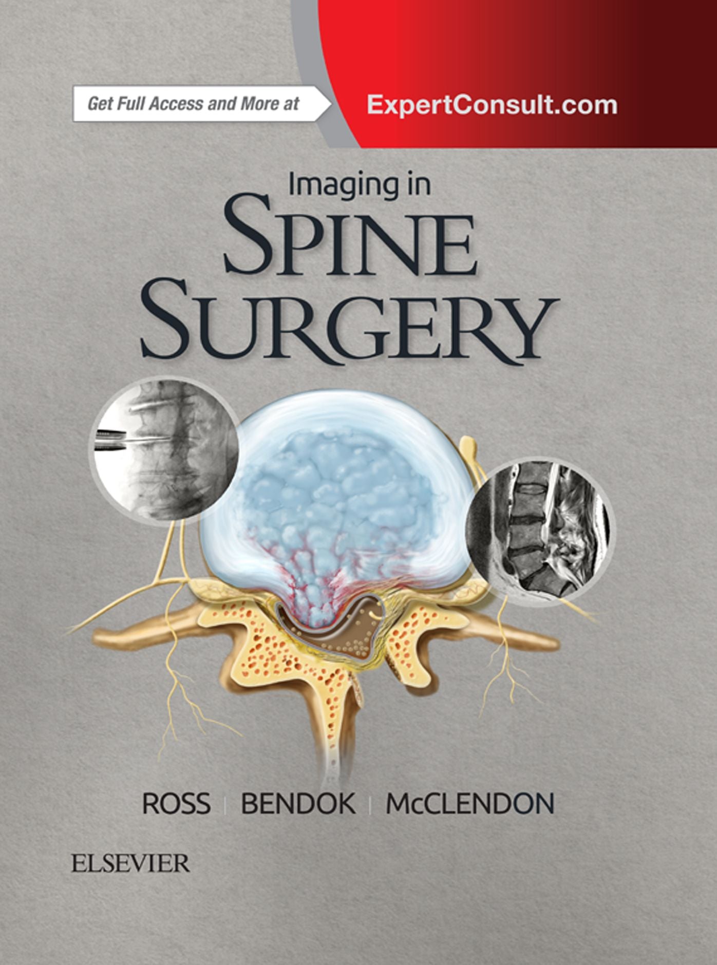 Imaging in Spine Surgery E-Book