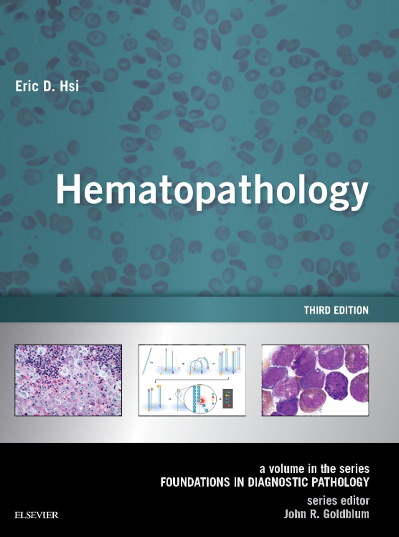Hematopathology E-Book: A Volume in the Series: Foundations in Diagnostic Pathology