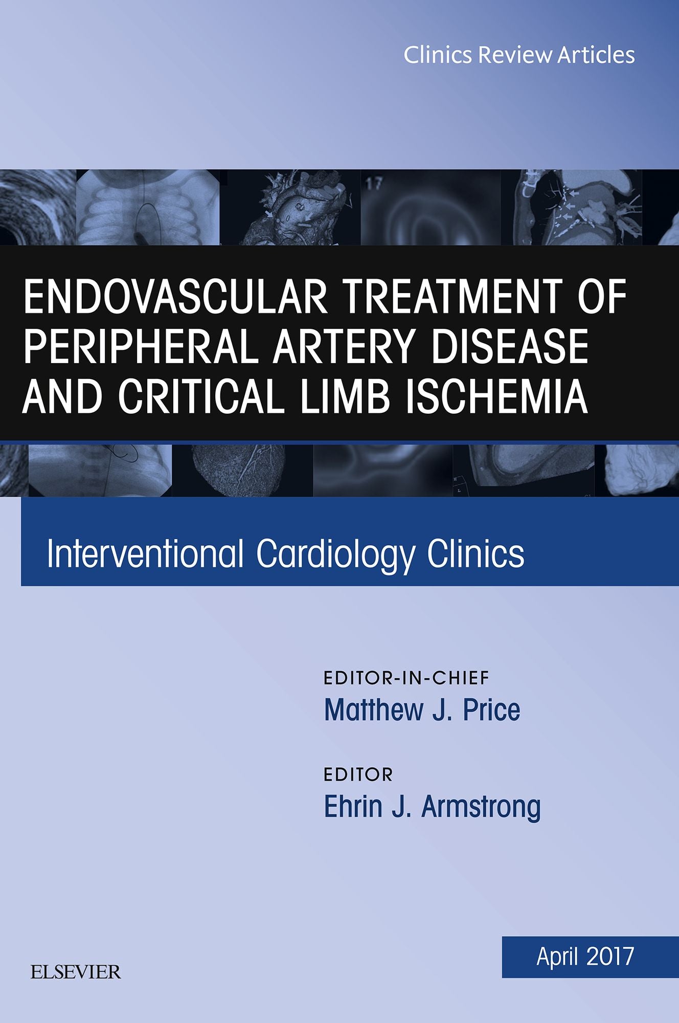 Endovascular Treatment of Peripheral Artery Disease and Critical Limb Ischemia, An Issue of Interventional Cardiology Clinics, E-Book