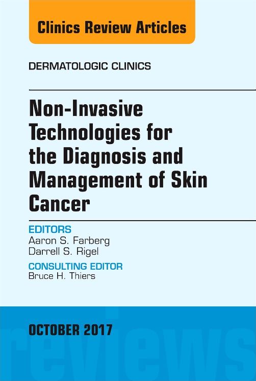 Non-Invasive Technologies for the Diagnosis and Management of Skin Cancer, E-Book
