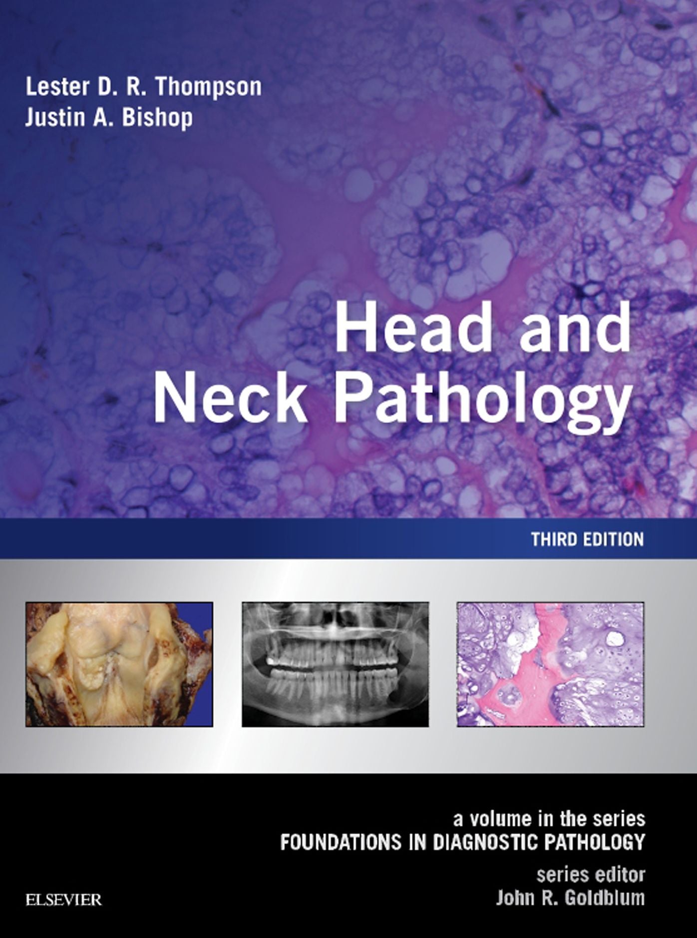 Head and Neck Pathology E-Book: A Volume in the Series: Foundations in Diagnostic Pathology