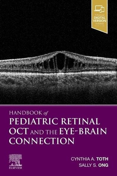 Handbook of Pediatric Retinal Oct and the Eye-brain Connection : Optical Coherence Tomography