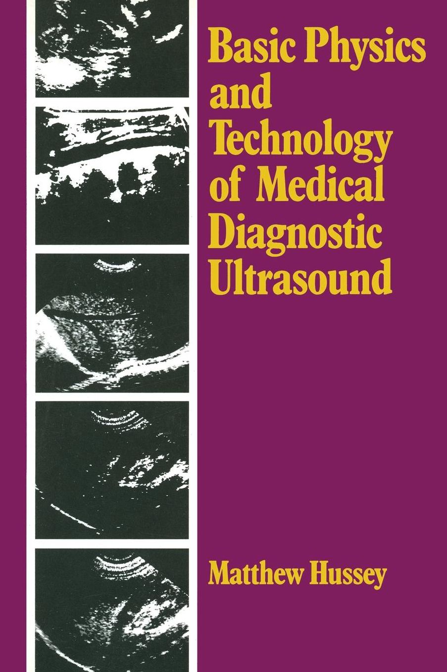 Basic Physics and Technology of Medical Diagnostic Ultrasound