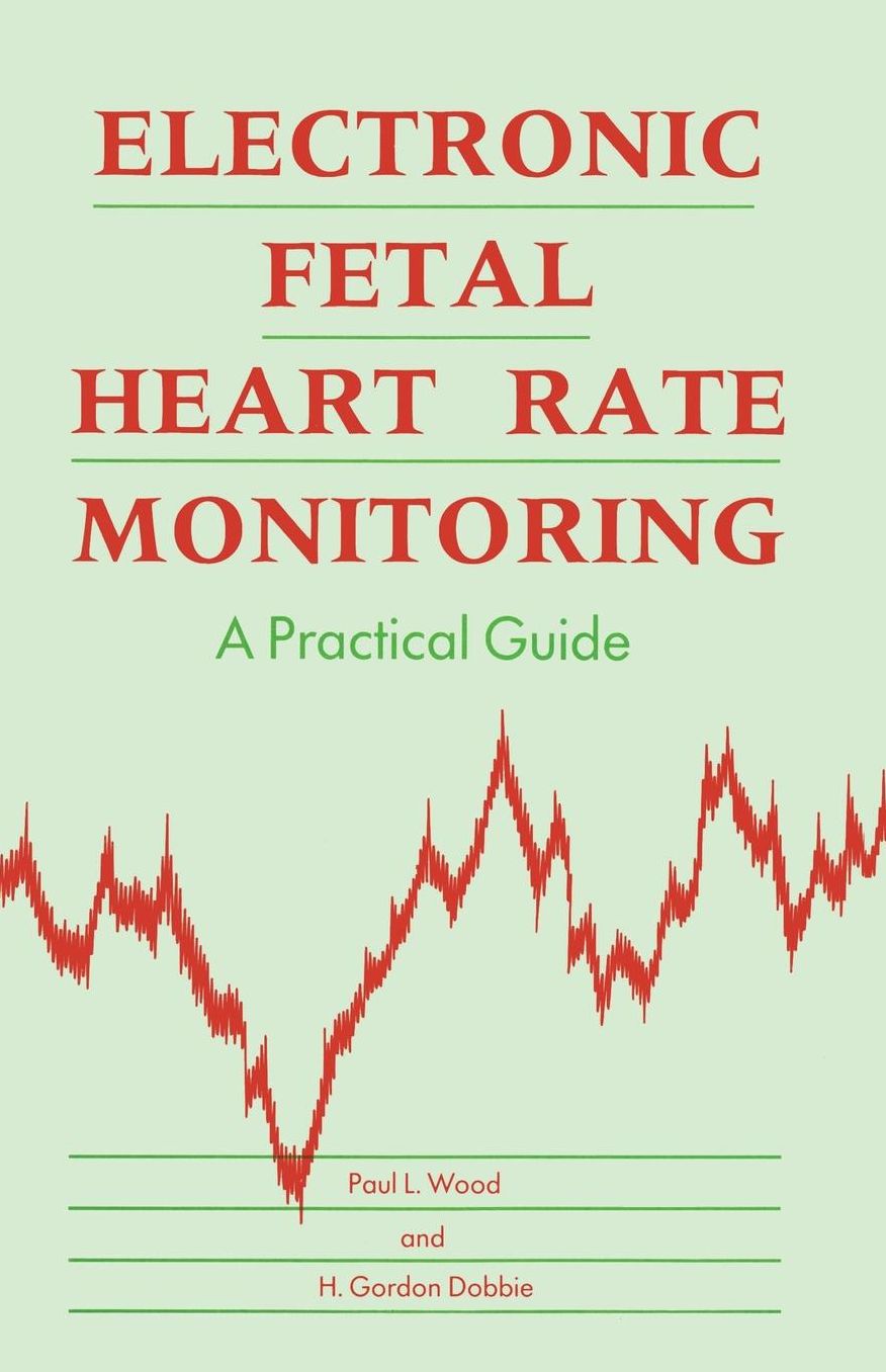Electronic Fetal Heart Rate Monitoring: A Practical Guide