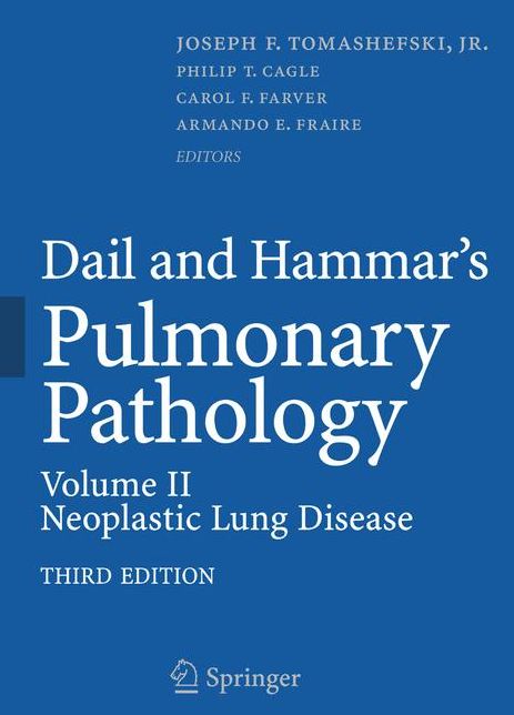 Dail and Hammar's Pulmonary Pathology: Volume II: Neoplastic Lung Disease