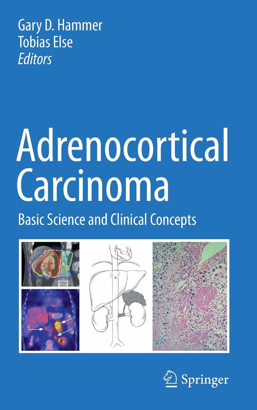 Adrenocortical Carcinoma: Basic Science and Clinical Concepts