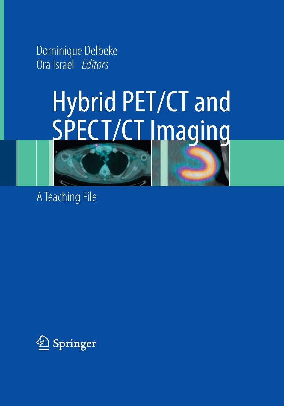 Hybrid PET/CT and SPECT/CT Imaging: A Teaching File