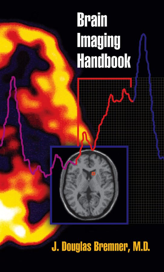 Brain Imaging Handbook