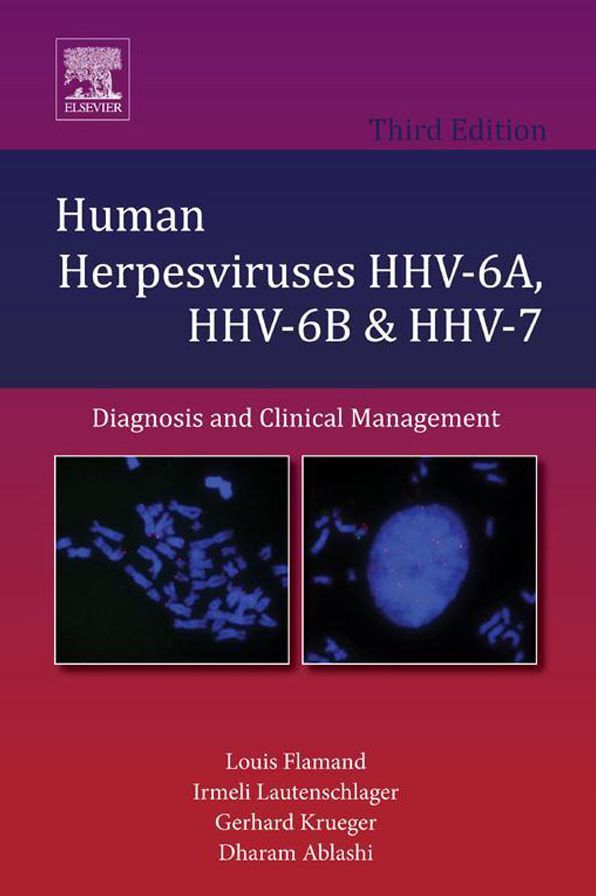 Human Herpesviruses HHV-6A, HHV-6B and HHV-7: Diagnosis and Clinical Management
