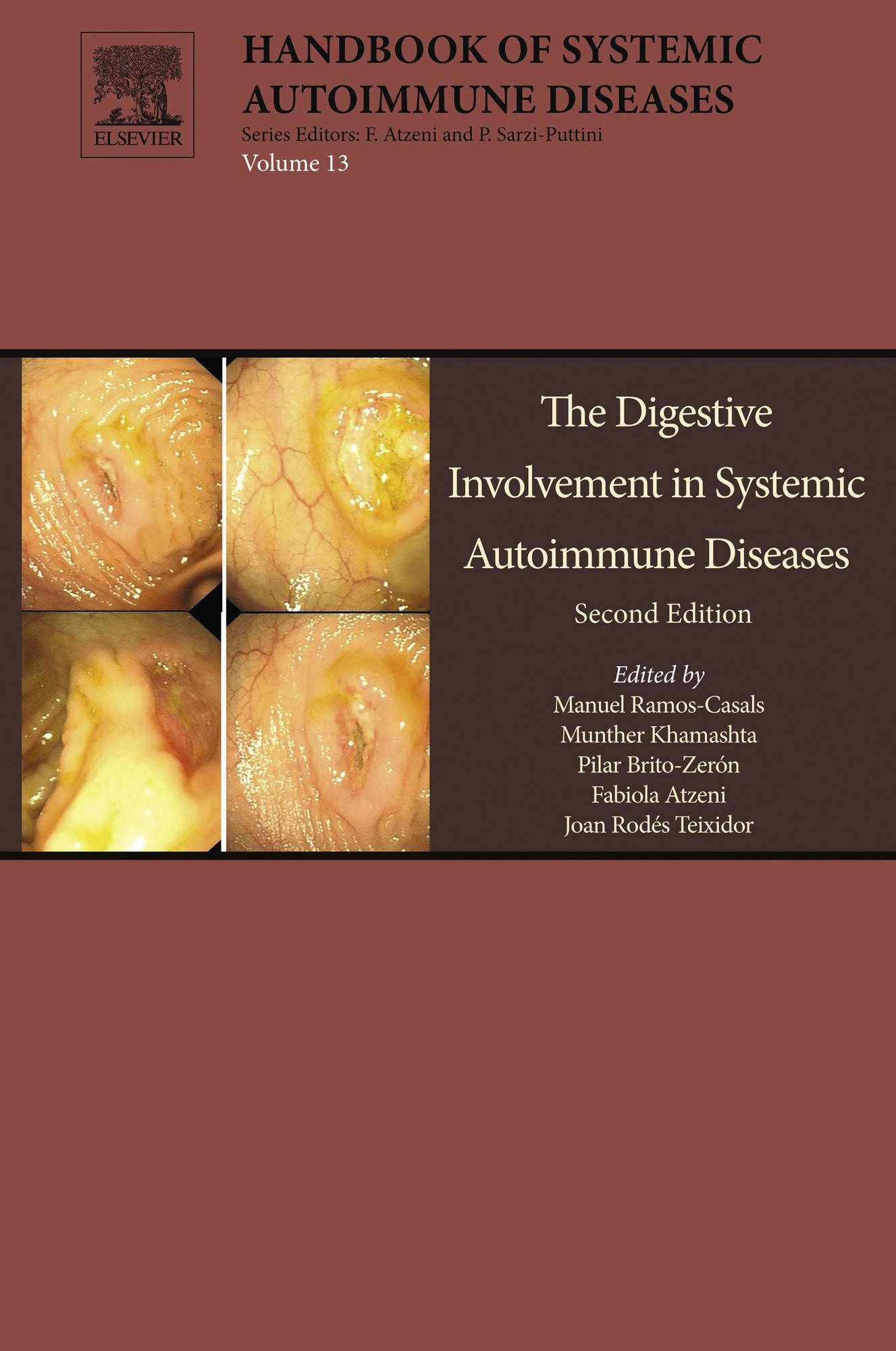 The Digestive Involvement in Systemic Autoimmune Diseases