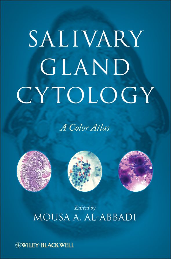 Salivary Gland Cytology: A Color Atlas