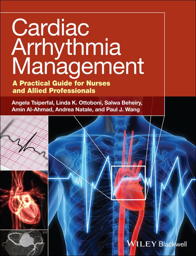 Cardiac Arrhythmia Management: A Practical Guide for Nurses and Allied Professionals
