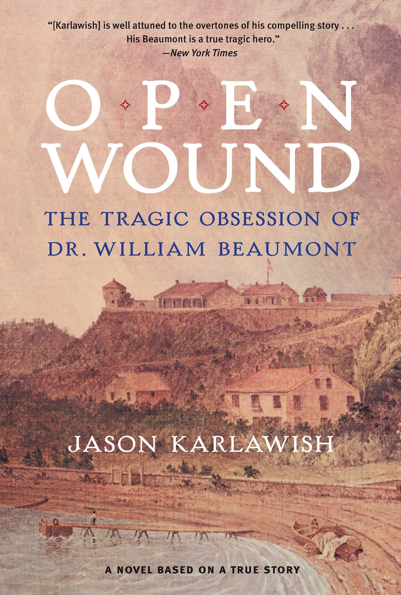 Open Wound: The Tragic Obsession of Dr. William Beaumont