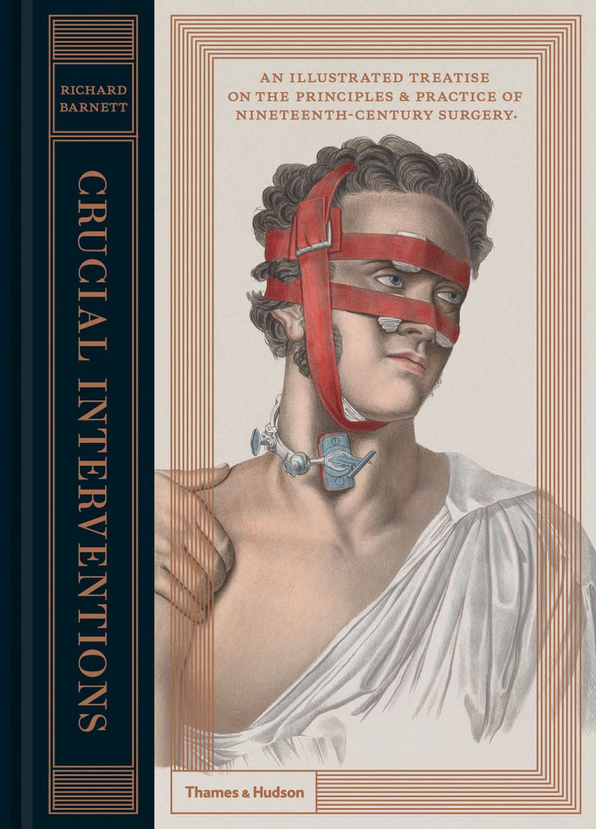 Crucial Interventions: An Illustrated Treatise on the Principles Practice of Nineteenth-Century Surgery