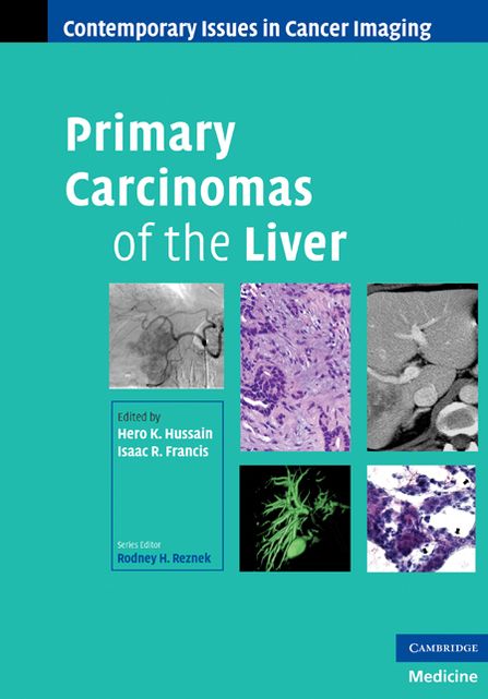 Primary Carcinomas of the Liver