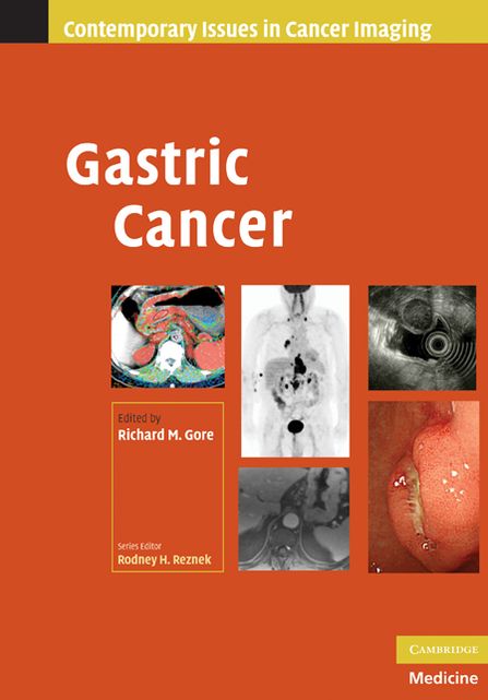 Gastric Cancer