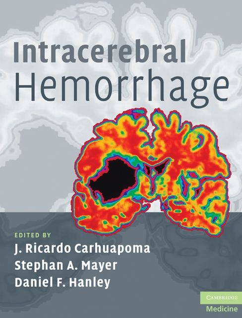 Intracerebral Hemorrhage